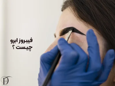 فیبروز ابرو چیست و چگونه انجام می شود ؟