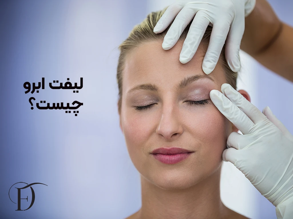 لیفت ابرو چیست