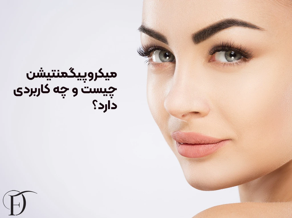 میکروپیگمنتیشن چیست و چه کاربردی دارد؟