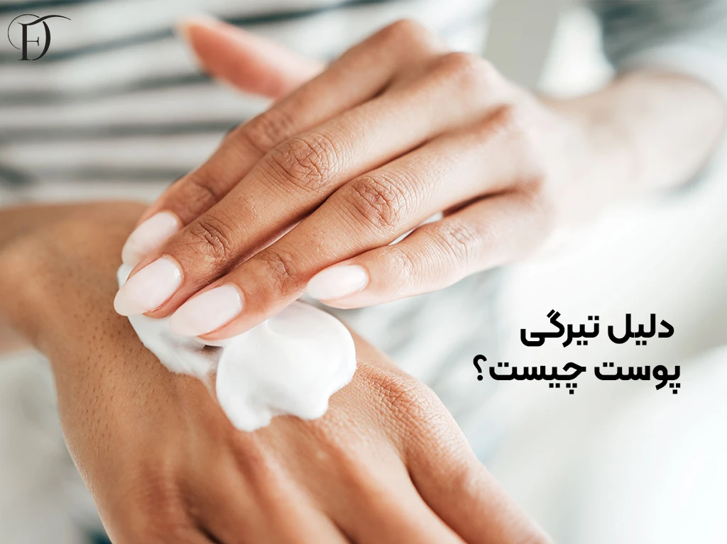 دلیل تیرگی پوست
