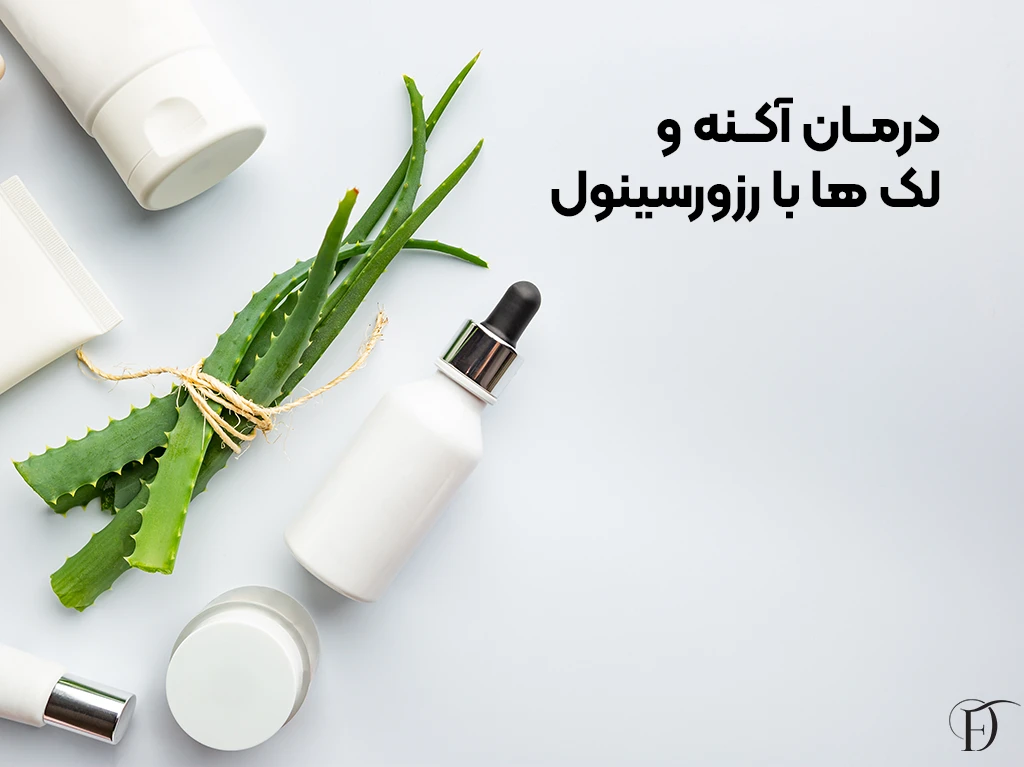 درمان آکنه و لک با رزورسینول