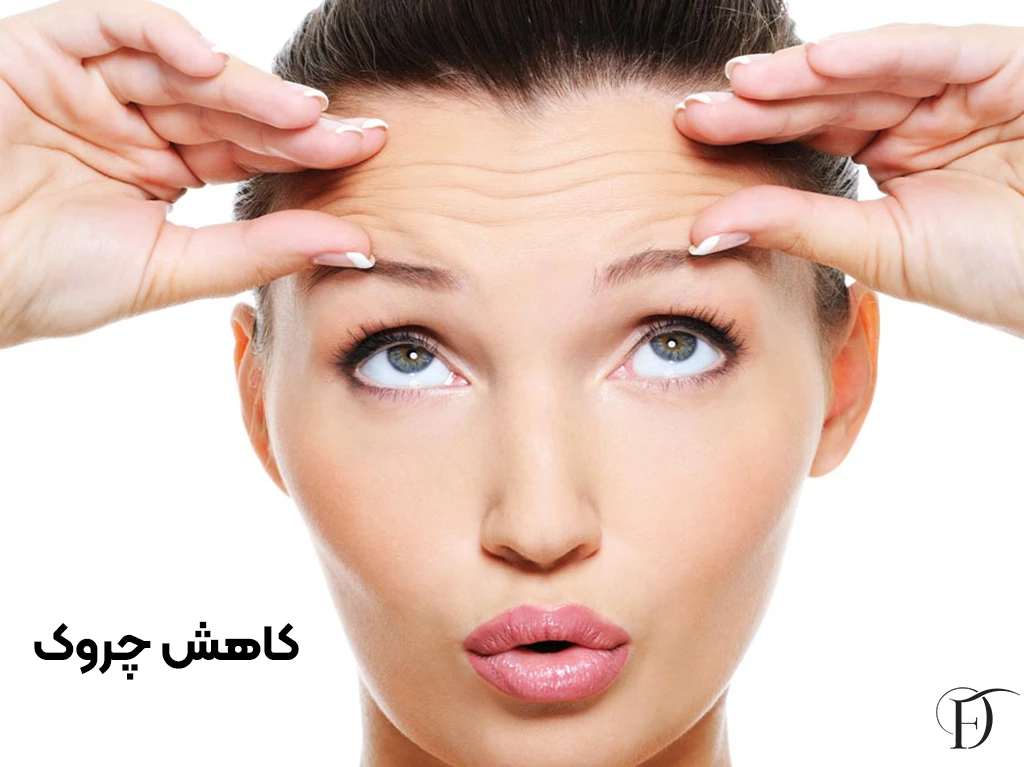 کاهش خطوط ریز