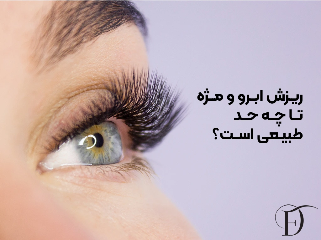 ریزش ابرو و مژه