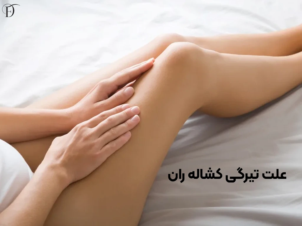 دلایل تیرگی کشاله ران و ناحیه تناسلی
