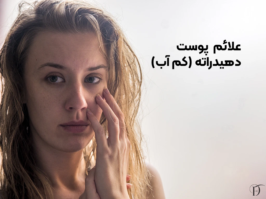 علائم رایج پوست دهیدراته (کم آب)