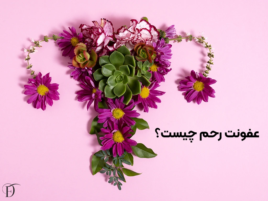 عفونت رحم