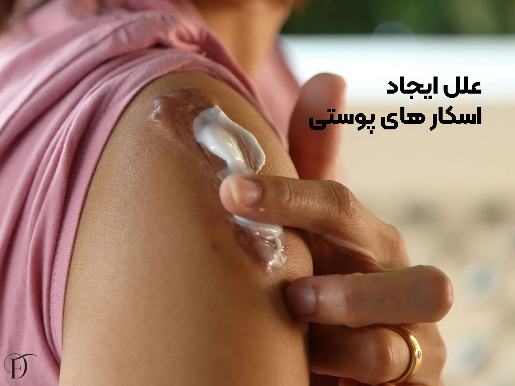 دلیل ایجاد اسکار پوستی