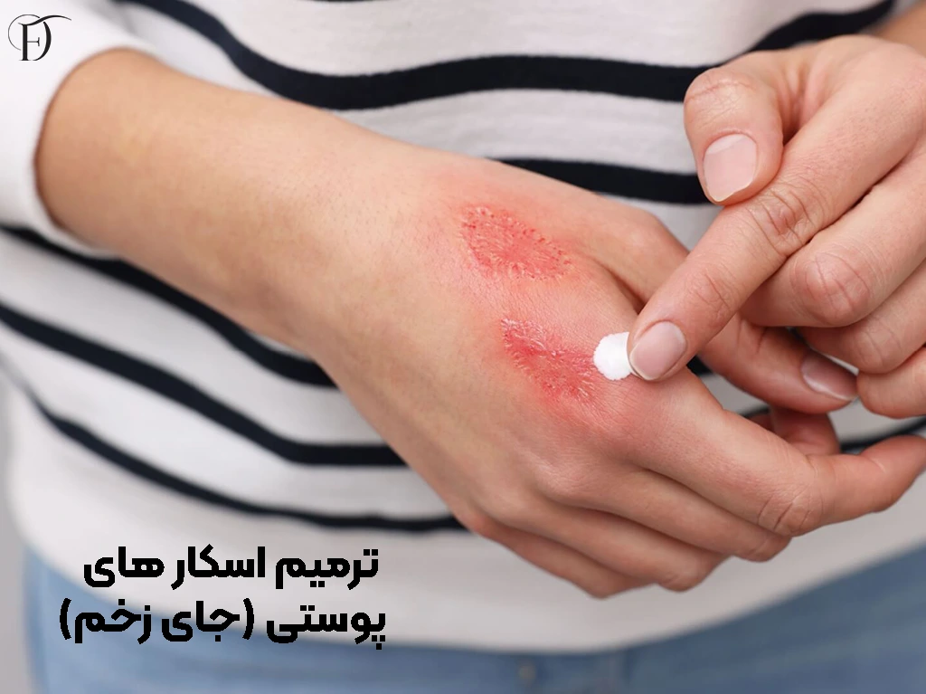 ترمیم جای زخم با کرم ترمیم کننده