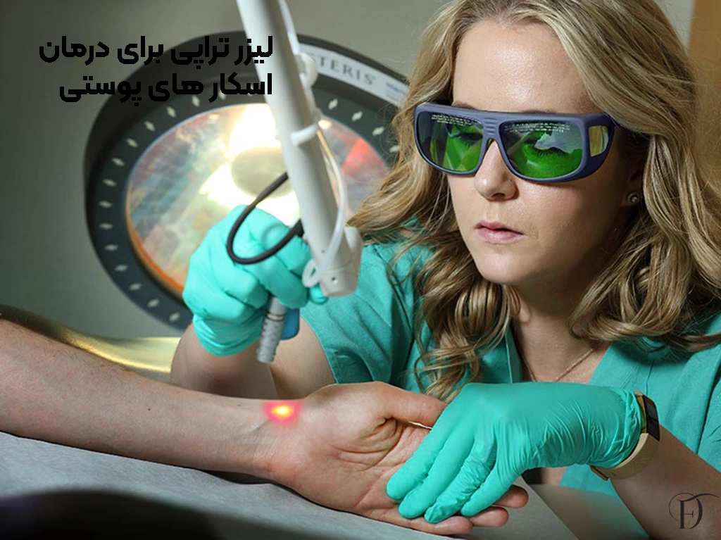 روش تخصصی درمان اسکار پوستی