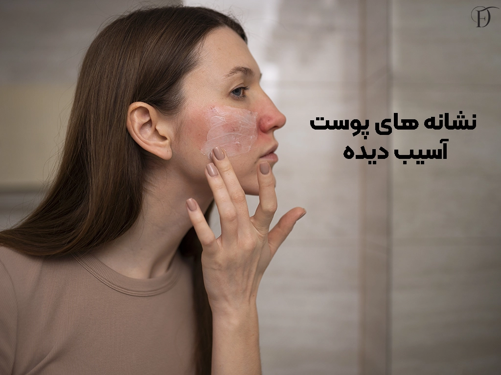 پوست آسیب دیده 