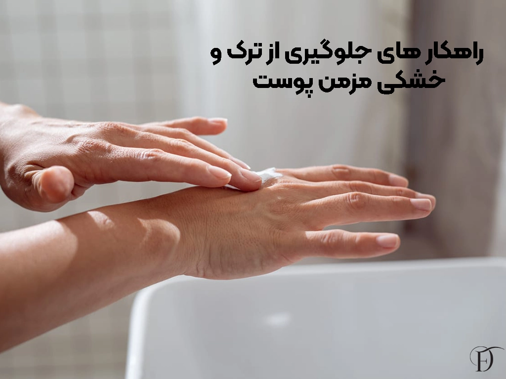 جلوگیری از خشکی و ترک پوست