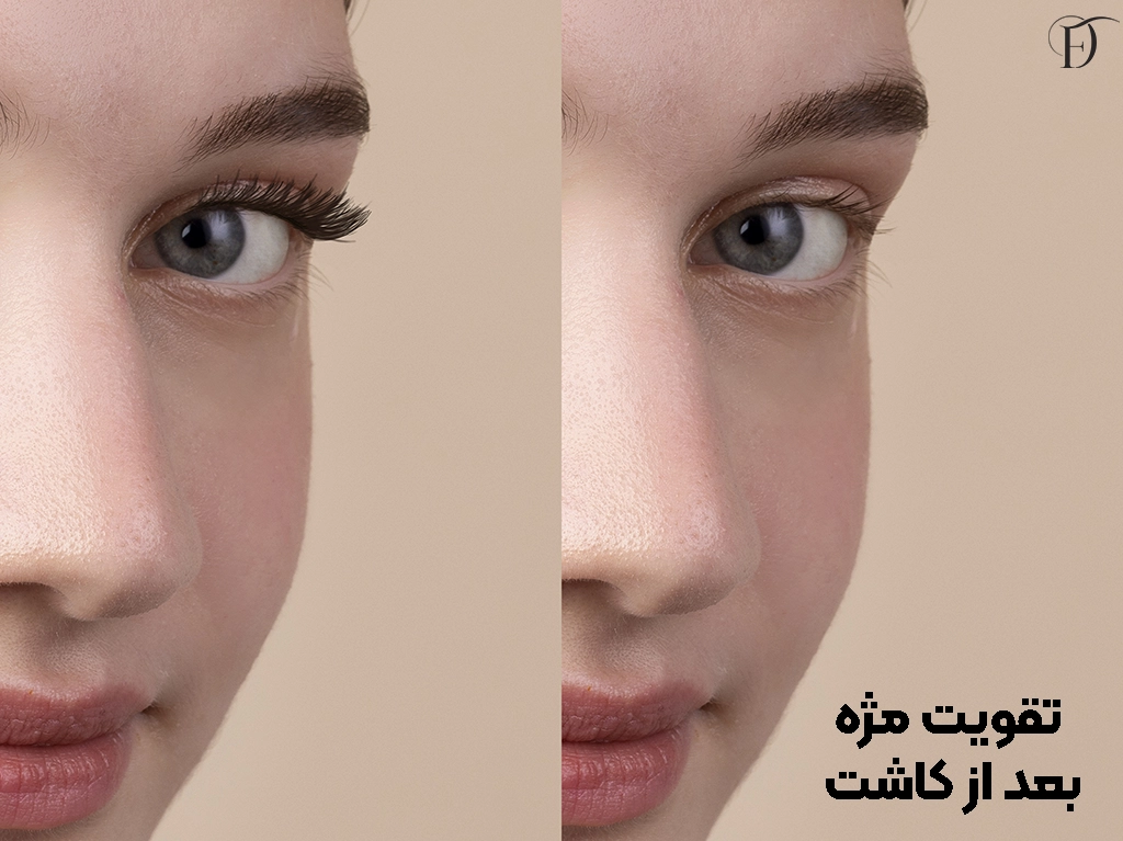 تقویت مژه
