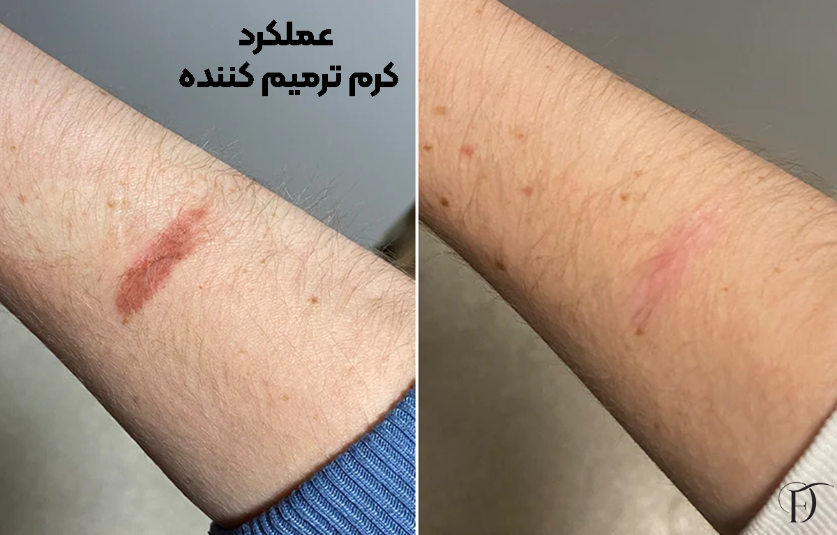 عملکرد کرم ترمیم کننده