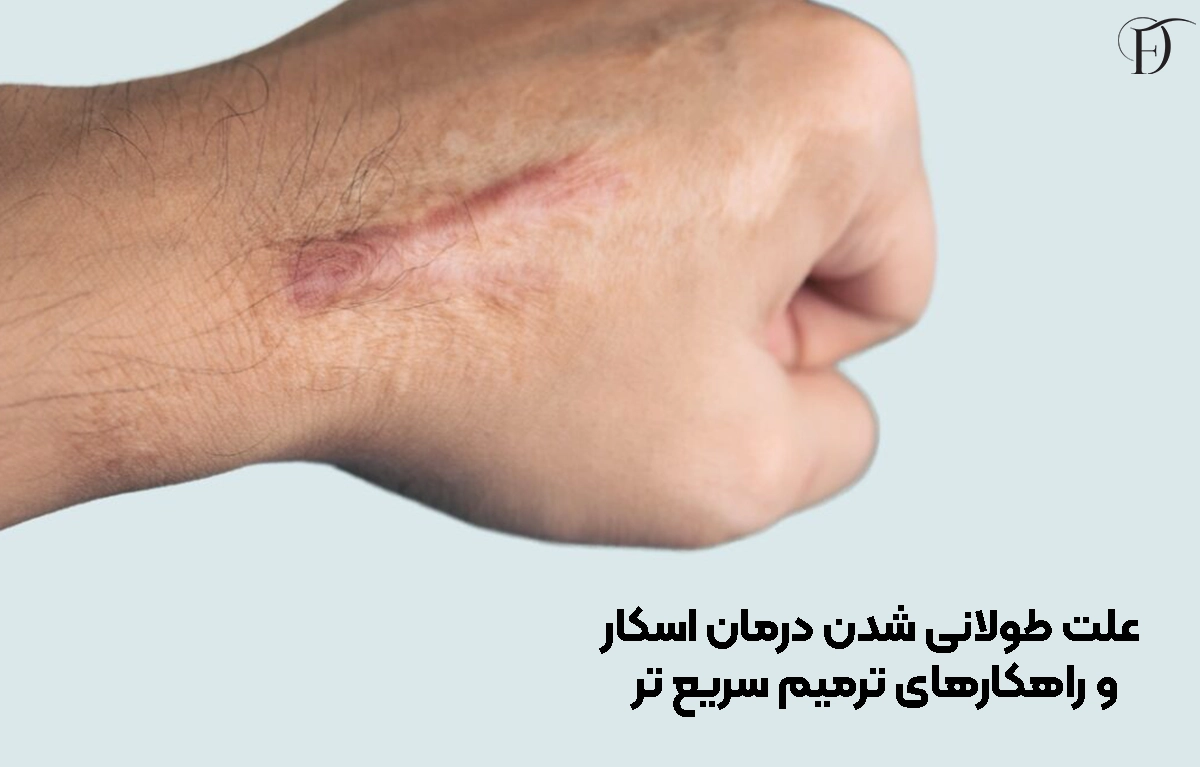 علت طولانی شدن درمان اسکار و راهکارهای ترمیم سریع‌ تر