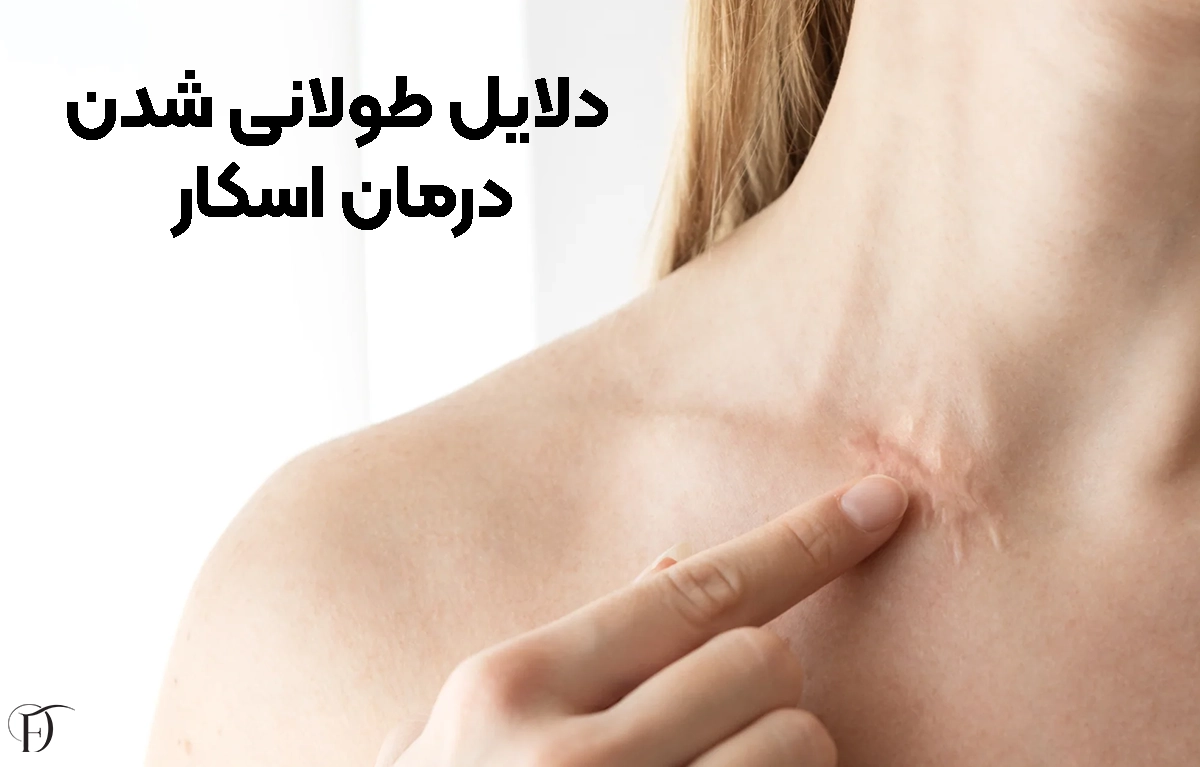 دلایل طولانی شدن اسکار