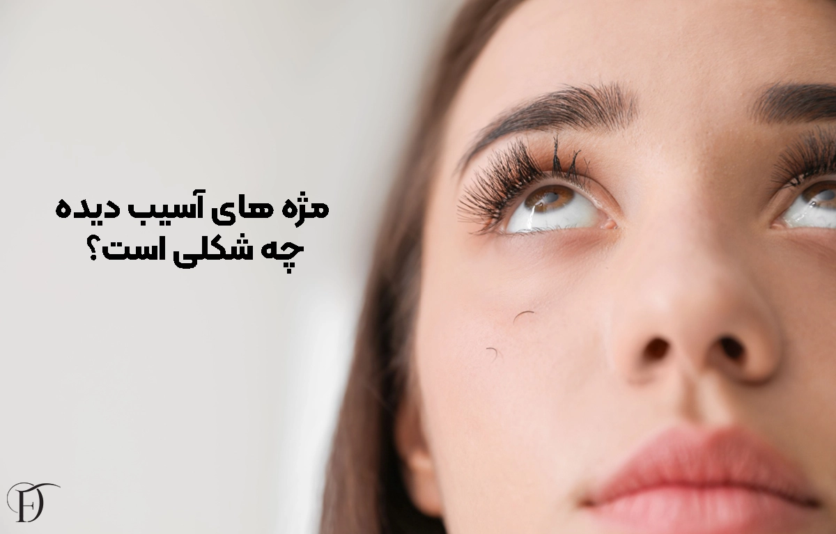 شکل مژه های آسیب دیده