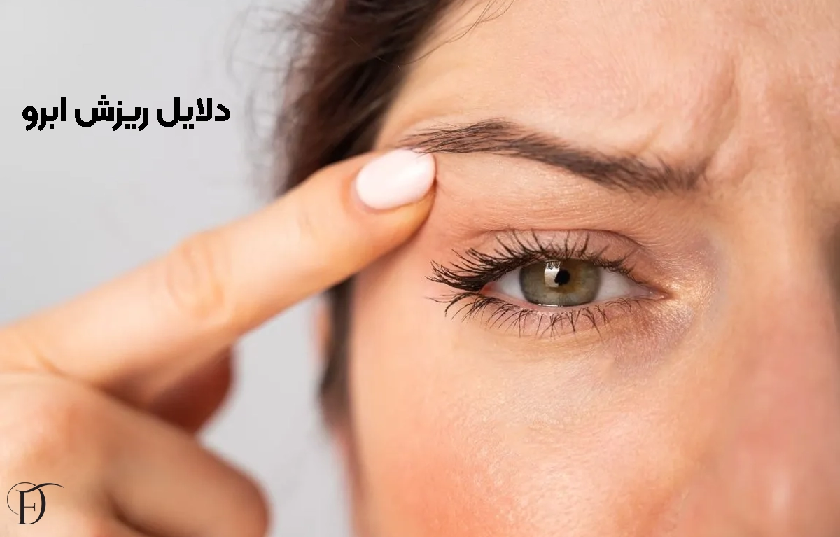 دلایل ریزش ابرو