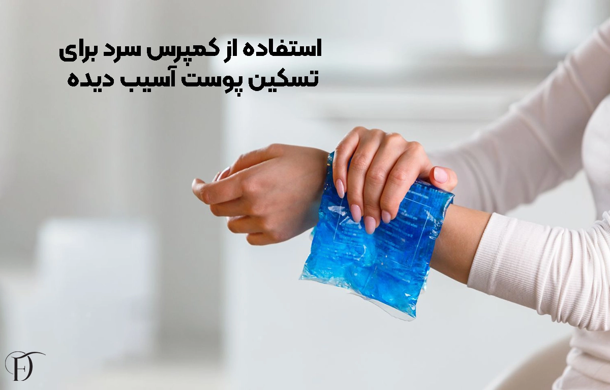 تسکین پوست آسیب ‌دیده با کمپرس سرد