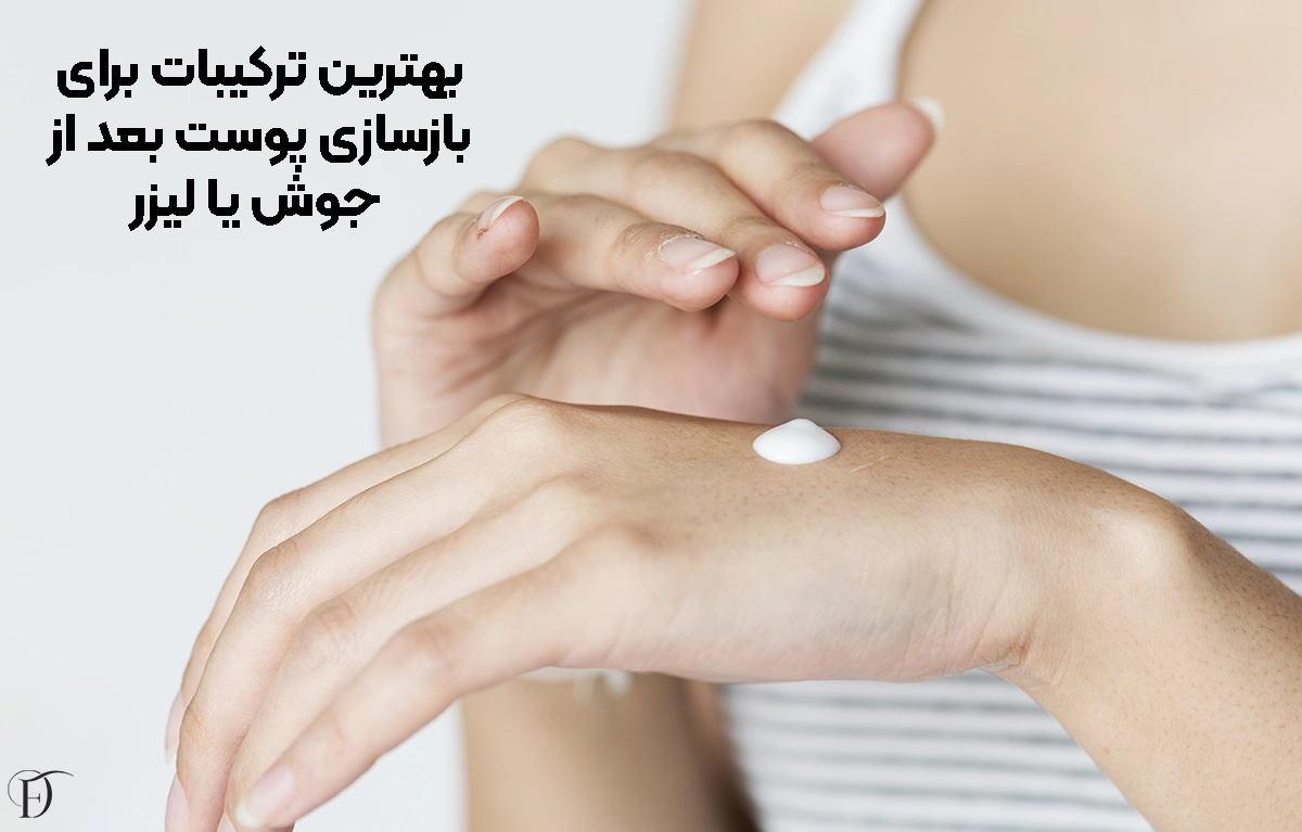 بهترین ترکیبات برای بازسازی پوست بعد از جوش یا لیزر