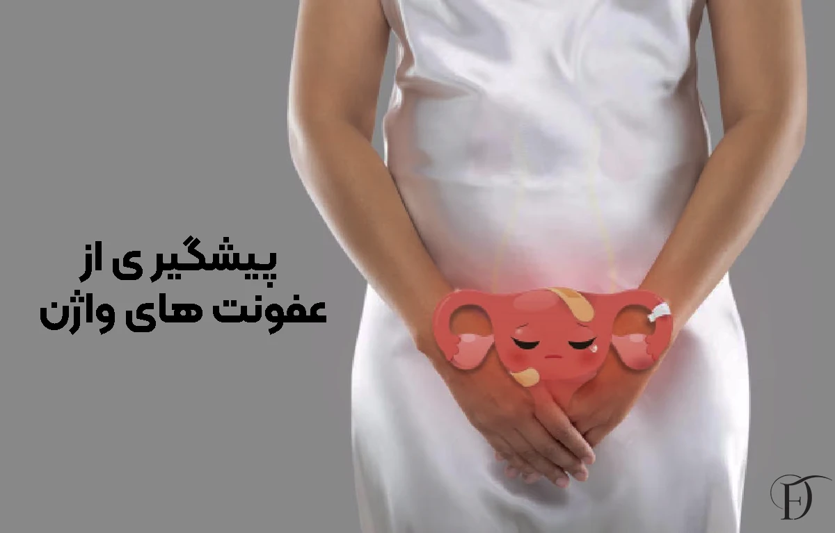 پیشگیری از عفونت واژن