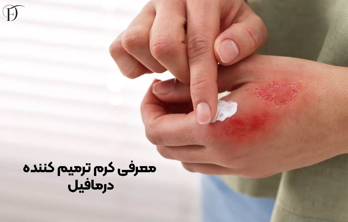 معرفی کرم ترمیم کننده