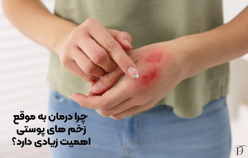 چرا درمان به موقع زخم ‌های پوستی اهمیت زیادی دارد؟