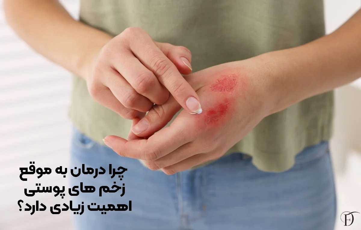 چرا درمان به موقع زخم ‌های پوستی اهمیت زیادی دارد؟