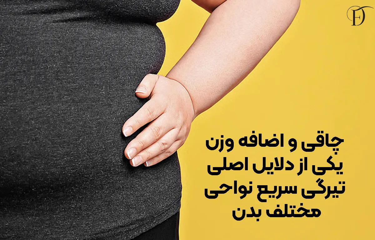 چاقی و اضافه وزن یکی از دلایل اصلی تیرگی سریع نواحی مختلف بدن