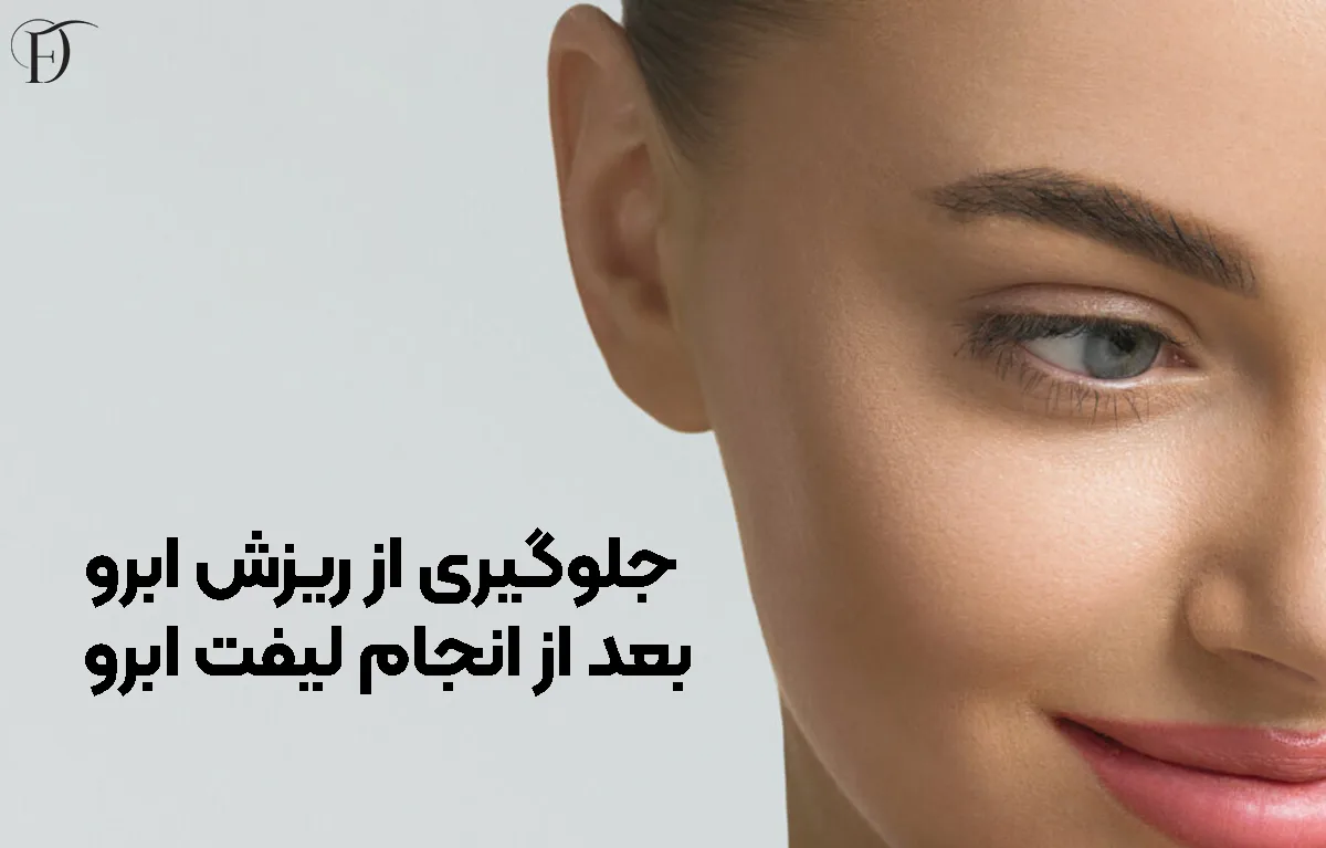 جلوگیری از ریزش ابر.