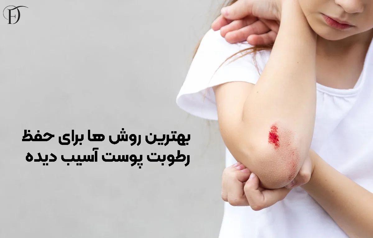 بهترین روش حفظ رطوبت پوست آسیب دیده
