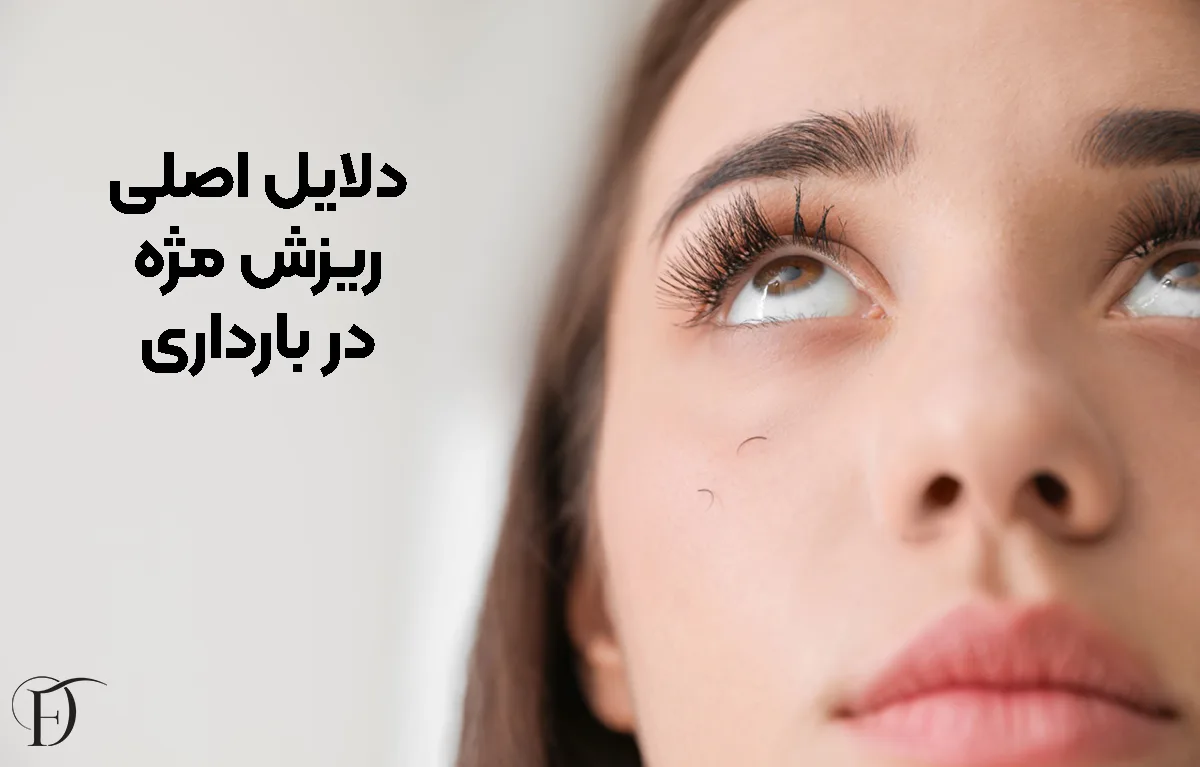 دلایل اصلی ریزش مژه در این دوران
