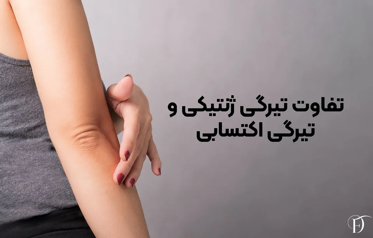 تفاوت تیرگی ژنتیکی و تیرگی اکتسابی