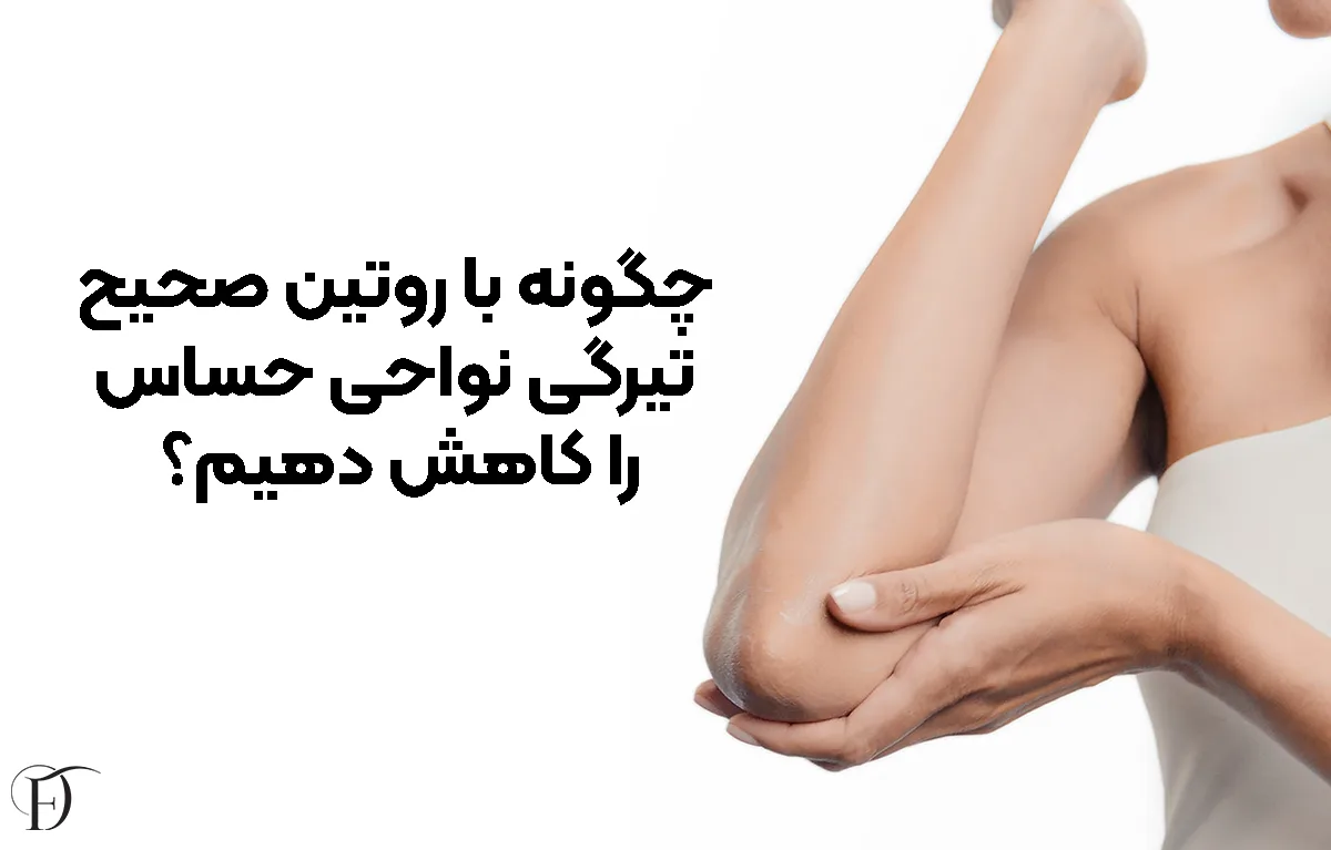 چگونه با روتین صحیح، تیرگی نواحی حساس را کاهش دهیم؟