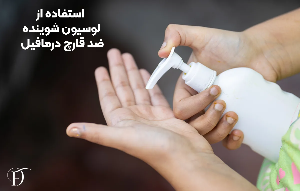 استفاده از لوسیون شوینده ضد قارچ
