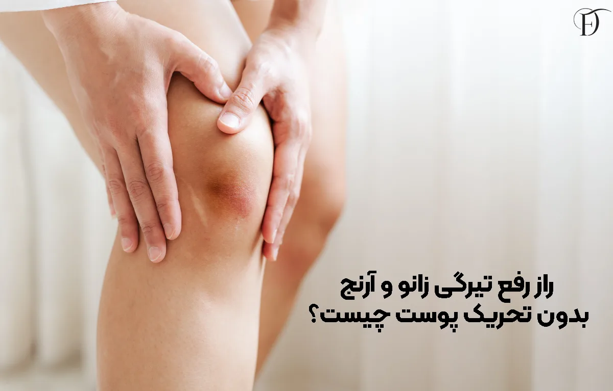 راز رفع تیرگی زانو و آرنج بدون تحریک پوست چیست؟