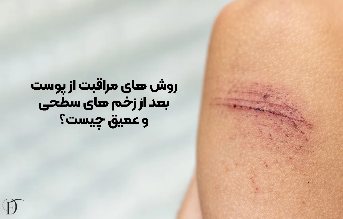 روش‌ های مراقبت از پوست بعد از زخم‌ های سطحی و عمیق چیست؟