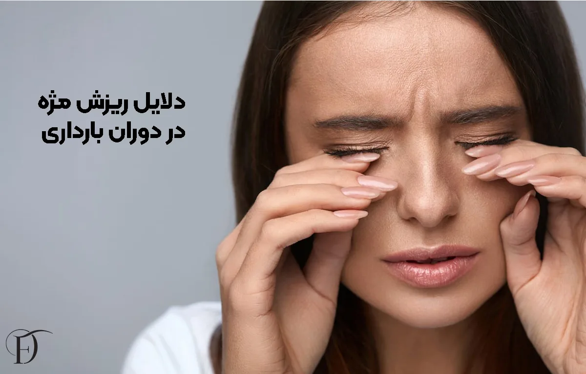 دلایل ریزش مژه در بارداری