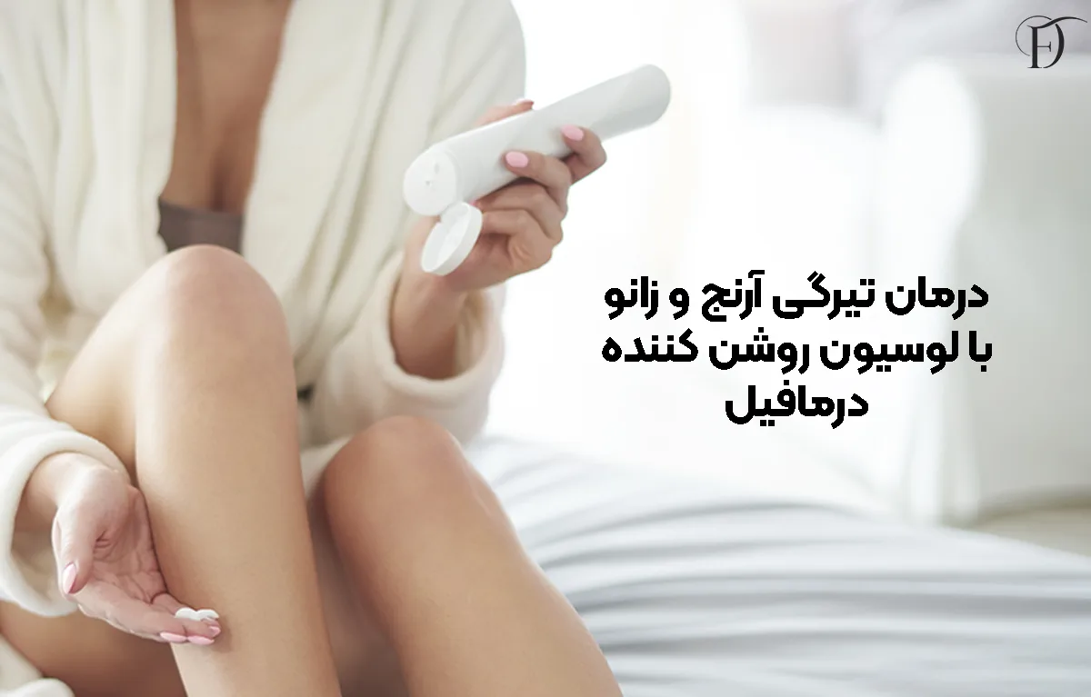ترکیبات لوسیون روشن کننده