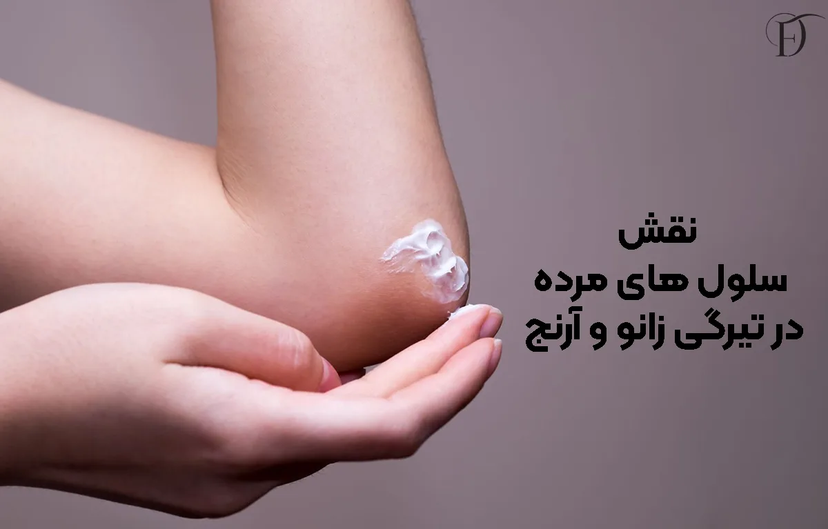 نقش سلول‌ های مرده در تیرگی زانو و آرنج