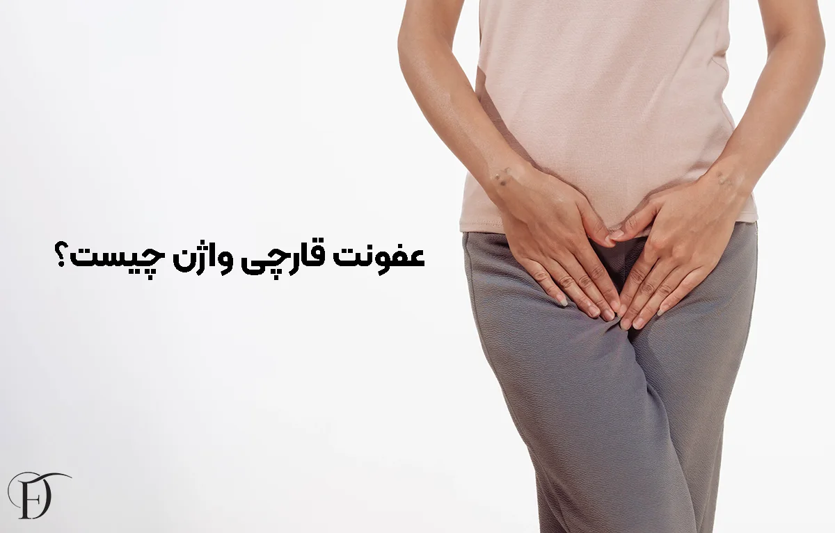 تعریف عفونت قارچی واژن