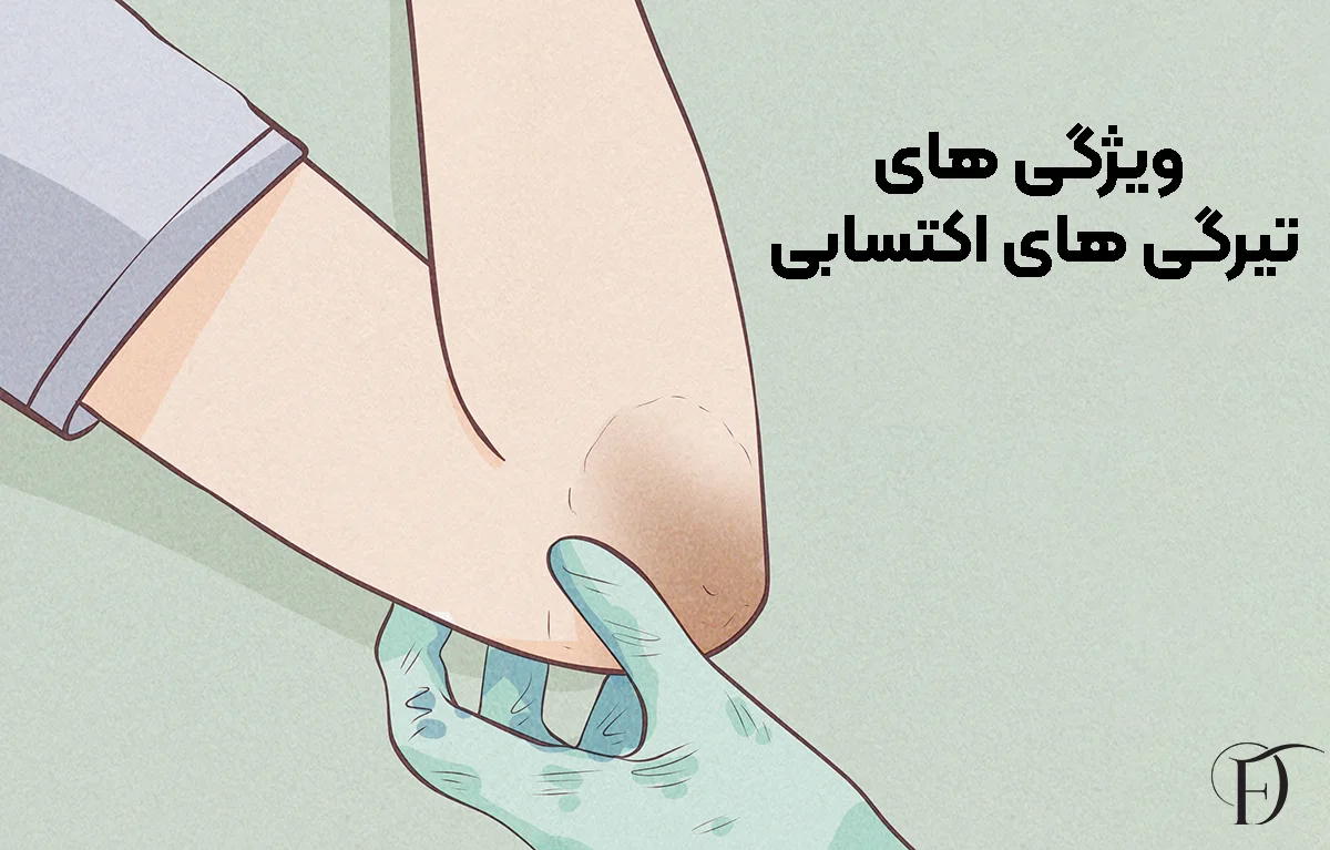 ویژگی های تیرگی اکتسابی