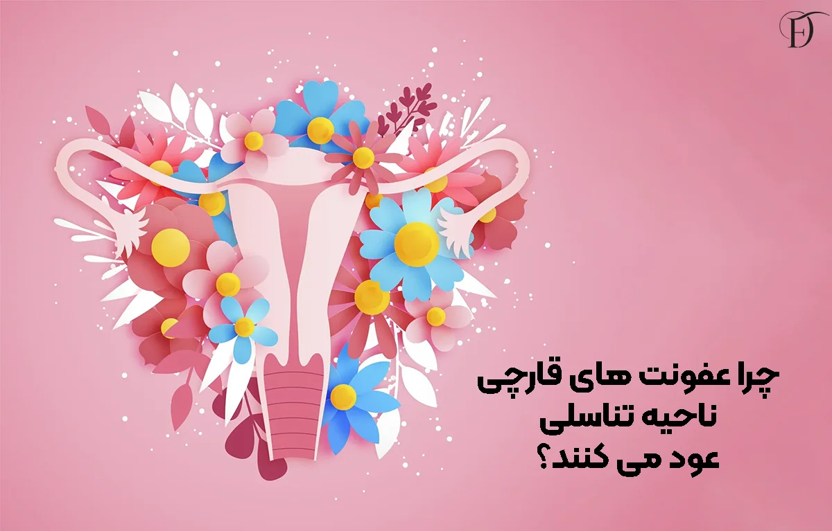 چرا عفونت‌ های قارچی ناحیه تناسلی عود می ‌کنند؟