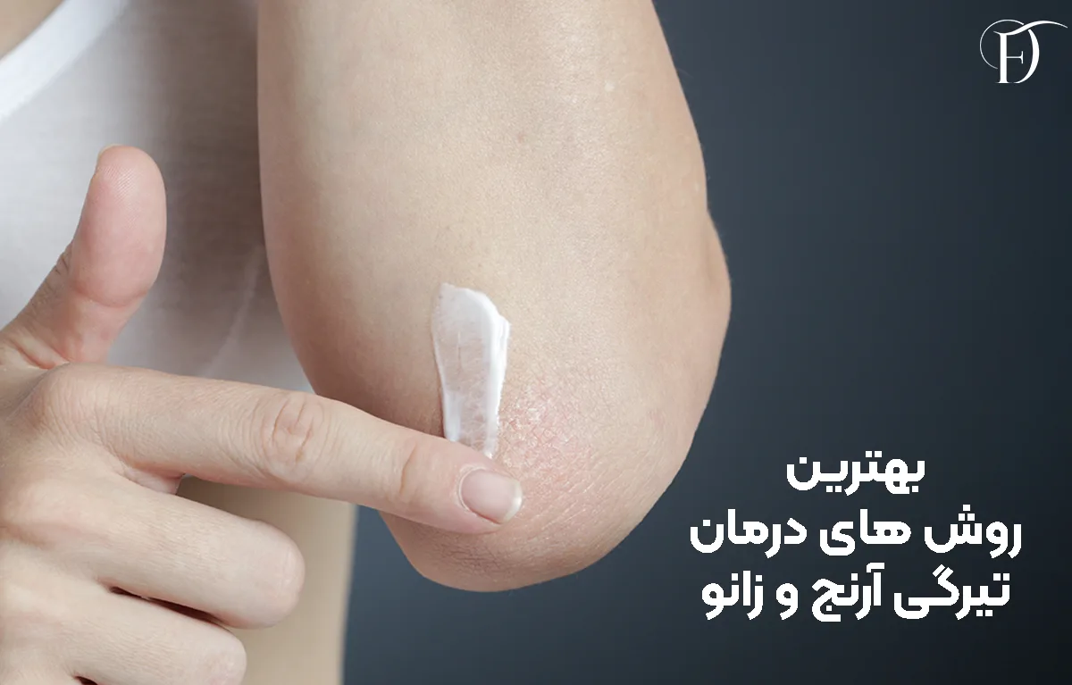 درمان تیرگی آرنج و زانو