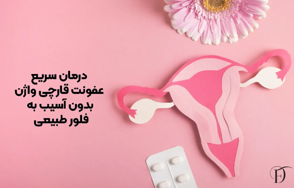 درمان سریع عفونت قارچی واژن بدون آسیب به فلور طبیعی