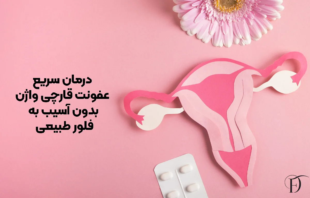 درمان سریع عفونت قارچی واژن بدون آسیب به فلور طبیعی