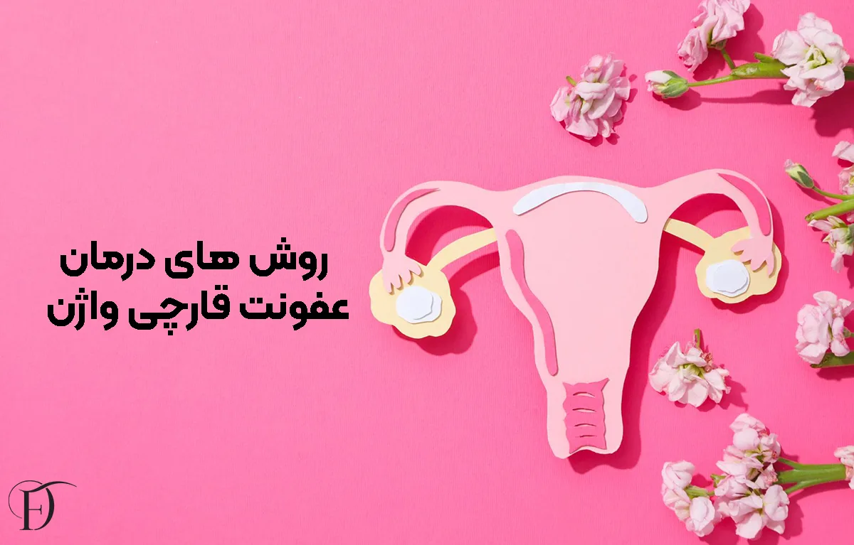روش های درمان عفونت قارچی واژن