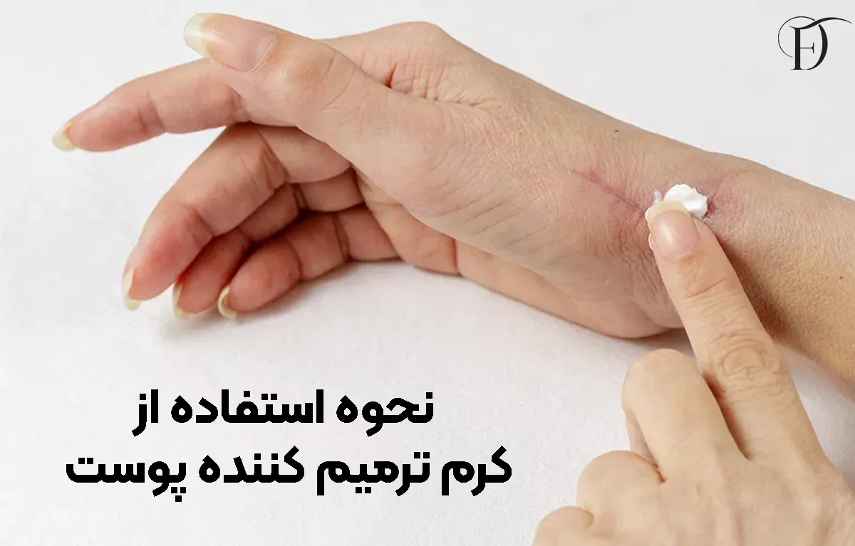 استفاده از کرم ترمیم کننده پوست