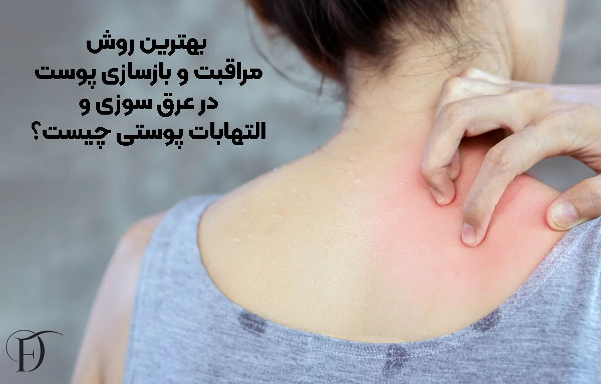 بهترین روش مراقبت و بازسازی پوست در عرق ‌سوزی و التهابات پوستی چیست؟