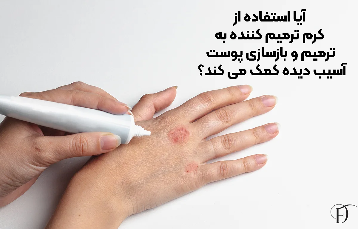 آیا استفاده از کرم ترمیم ‌کننده به ترمیم و بازسازی پوست آسیب ‌دیده کمک می ‌کند؟