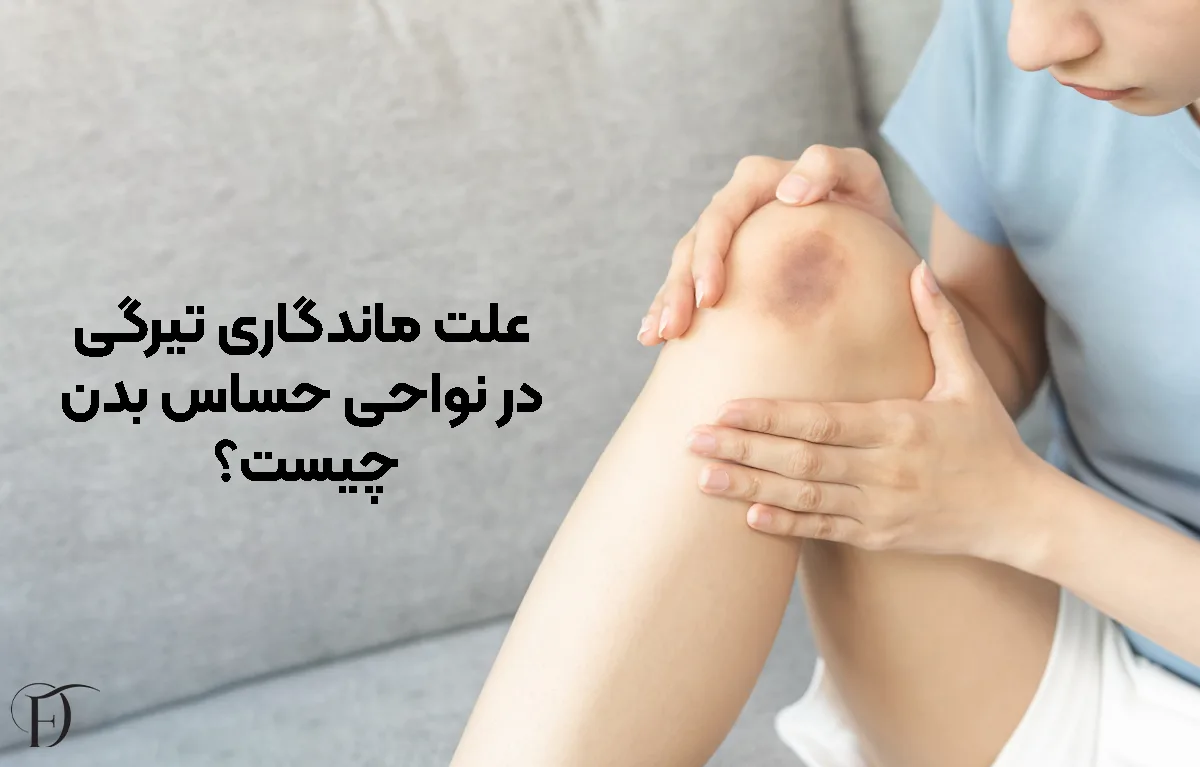 علت ماندگاری تیرگی در نواحی حساس بدن چیست؟